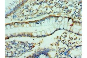 Immunohistochemistry of paraffin-embedded human small intestine tissue using ABIN7147898 at dilution of 1:100 (Claudin 2 抗体  (AA 30-230))