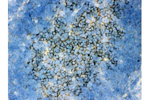 Anti- SQSTM1 Picoband antibody,IHC(F) IHC(F): Rat Spleen Tissue (SQSTM1 抗体  (N-Term))