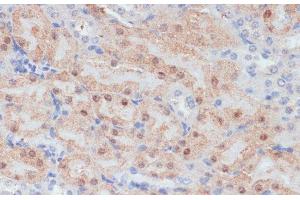 Immunohistochemistry of paraffin-embedded Mouse kidney using CLDN17 Polyclonal Antibody at dilution of 1:100 (40x lens). (Claudin 17 抗体)