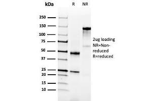 SDS-PAGE Analysis Purified NKX3. (NKX3-1 抗体  (AA 92-224))
