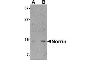 Western Blotting (WB) image for anti-Norrie Disease (Pseudoglioma) (NDP) (N-Term) antibody (ABIN1031487) (Norrie Disease (Pseudoglioma) 抗体  (N-Term))