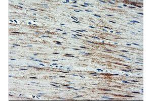 Immunohistochemical staining of paraffin-embedded Human colon tissue using anti-ARL11 mouse monoclonal antibody.