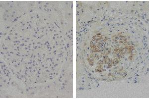 Paraffin embedded glomerular basement membrane tissue sections from patients with Anti-GBM disease were stained with Mouse Anti-Human IgG3 Hinge-UNLB (小鼠 anti-人 IgG3 (Hinge Region) Antibody)