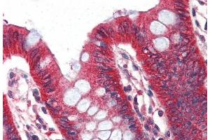 (ABIN190818) (2 μg/mL) staining of paraffin embedded Human Colon. (PLIN1 抗体  (Internal Region))