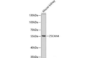 Western blot analysis of extracts of Mouse kidney using ZSCAN4C Polyclonal Antibody at dilution of 1:1000. (ZSCAN4C 抗体)