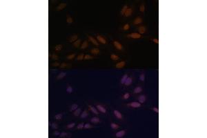 Immunofluorescence analysis of U-2 OS cells using EED Polyclonal Antibody (ABIN6133691, ABIN6139940, ABIN6139943 and ABIN6216521) at dilution of 1:100 (40x lens). (EED 抗体  (AA 1-100))