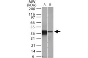 Western blot analysis of NFKBIA. (NFKBIA 抗体  (AA 32-291))