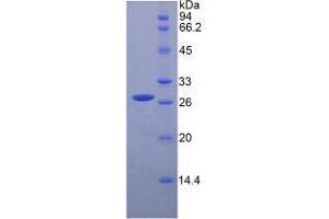 SDS-PAGE analysis of Mouse HGF Protein. (HGF 蛋白)