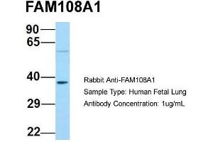 Host: Rabbit  Target Name: FAM108A1  Sample Tissue: Human Fetal Lung  Antibody Dilution: 1. (ABHD17A 抗体  (C-Term))