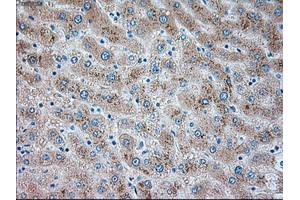 Immunohistochemical staining of paraffin-embedded liver tissue using anti-TRPM4mouse monoclonal antibody. (TRPM4 抗体)