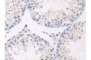 Detection of GnRH in Mouse Testis Tissue using Polyclonal Antibody to Gonadotropin Releasing Hormone (GnRH) (GNRH1 抗体  (AA 22-90))