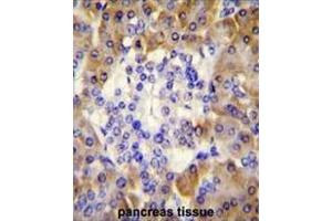Immunohistochemistry (Paraffin-embedded Sections) (IHC (p)) image for anti-Peroxiredoxin 4 (PRDX4) (AA 89-118), (Middle Region) antibody (ABIN954101)