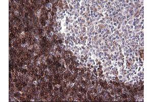 Immunohistochemistry (IHC) image for anti-T-cell surface glycoprotein CD1c (CD1C) antibody (ABIN2670659) (CD1c 抗体)