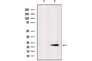 Western blot analysis of extracts from mouse lung, using PPP1R2P3 Antibody. (PPP1R2P3 抗体)