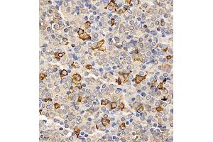 Immunohistochemistry of paraffin embedded mouse hypophysis using TSH (ABIN7075906) at dilution of 1:400 (400x lens)