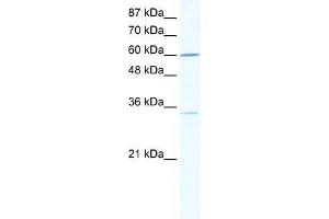 Human Jurkat; WB Suggested Anti-ZNF668 Antibody Titration: 0. (ZNF668 抗体  (N-Term))