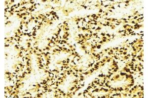 Immunohistochemistry (IHC) image for anti-Proteasome (Prosome, Macropain) 26S Subunit, Non-ATPase, 10 (PSMD10) (C-Term) antibody (ABIN6264484)