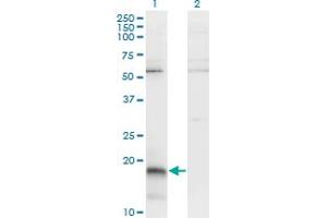 Western Blot analysis of PAEP expression in transfected 293T cell line by PAEP monoclonal antibody (M01), clone 6G2. (PAEP 抗体  (AA 53-162))