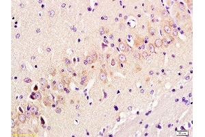 Formalin-fixed and paraffin embedded: rat brain tissue labeled with Anti-GAP-43 Polyclonal Antibody, Unconjugated  at 1:300 followed by conjugation to the secondary antibody and DAB staining (GAP43 抗体  (AA 9-100))