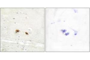 Immunohistochemistry analysis of paraffin-embedded human brain tissue, using EGR3 Antibody. (EGR3 抗体  (AA 338-387))