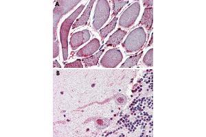 Immunohistochemical staining of formalin-fixed, paraffin-embedded human skeletal muscle (A) and human brain (B), cerebellum tissue after heat-induced antigen retrieval. (NEK7 抗体  (N-Term))