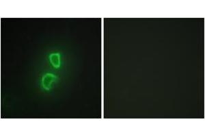 Immunofluorescence (IF) image for anti-Tumor Necrosis Factor (Ligand) Superfamily, Member 11 (TNFSF11) (AA 41-90) antibody (ABIN2889310) (RANKL 抗体  (AA 41-90))
