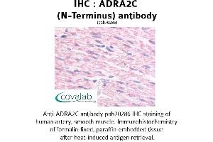 Image no. 1 for anti-Adrenergic, alpha-2C-, Receptor (ADRA2C) (Extracellular Domain), (N-Term) antibody (ABIN1731581)