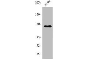 Western Blot analysis of HuvEc cells using UBE3C Polyclonal Antibody (UBE3C 抗体  (Internal Region))