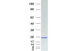 Western Blotting (WB) image for RAB6A, Member RAS Oncogene Family (RAB6A) (Transcript Variant 1) protein (Myc-DYKDDDDK Tag) (ABIN2730362)
