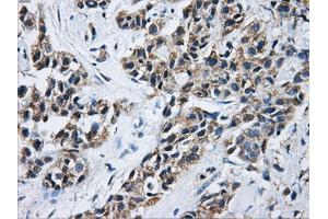 Immunohistochemical staining of paraffin-embedded Kidney tissue using anti-ACO2mouse monoclonal antibody. (ACO2 抗体)