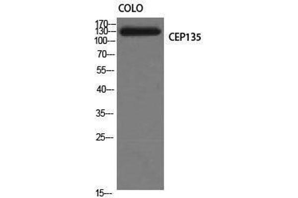 CEP135 抗体  (C-Term)