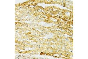 Immunohistochemistry of paraffin-embedded mouse heart using HSPA9 antibody. (HSPA9 抗体  (AA 380-679))