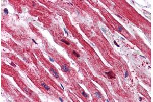 Human Heart: Formalin-Fixed, Paraffin-Embedded (FFPE) (SRPX 抗体  (N-Term))
