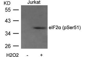 Western blot analysis of extracts from Jurkat cells untreated or treated with H2O2 using eIF2a(Phospho-Ser51) Antibody. (EIF2S1 抗体  (pSer51))