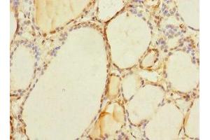 Immunohistochemistry of paraffin-embedded human thyroid tissue using ABIN7171504 at dilution of 1:100 (TAPBPL 抗体  (AA 201-468))