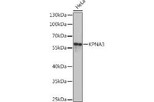 Western blot analysis of extracts of HeLa cells, using KPN Rabbit pAb  at 1:1000 dilution. (KPNA3 抗体  (AA 1-210))