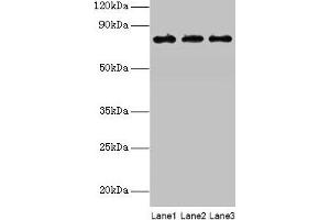 Western blot All lanes: KIRREL2 antibody at 8 μg/mL Lane 1: Mouse gonadal tissue Lane 2: Mouse lung tissue Lane 3: Mouse heart tissue Secondary Goat polyclonal to rabbit IgG at 1/10000 dilution Predicted band size: 76, 68, 62, 24 kDa Observed band size: 76 kDa (KIRREL2 抗体  (AA 21-219))