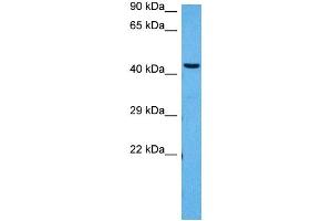 Host:  Rabbit  Target Name:  PPARD  Sample Tissue:  Mouse Brain  Antibody Dilution:  1ug/ml (PPARD 抗体  (N-Term))