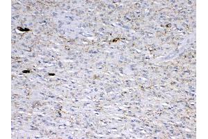 Immunohistochemistry (IHC) image for anti-Glutamate Decarboxylase 2 (Pancreatic Islets and Brain, 65kDa) (GAD2) (AA 84-182) antibody (ABIN5693229)