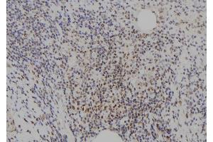 ABIN6273721 at 1/100 staining Human spleen tissue by IHC-P. (E2F8 抗体  (C-Term))