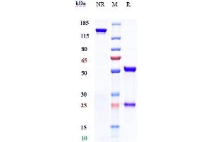 Anti-TROP2 Reference Antibody (sacituzumab) on SDS-PAGE under reducing (R) condition. (Recombinant Trop2 (Sacituzumab Biosimilar) 抗体)