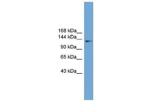 CCDC146 antibody used at 1 ug/ml to detect target protein. (CCDC146 抗体  (Middle Region))
