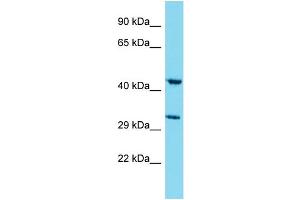 Western Blotting (WB) image for anti-Myb/SANT-Like DNA-Binding Domain Containing 4 with Coiled-Coils (MSANTD4) (N-Term) antibody (ABIN2791619) (MSANTD4 抗体  (N-Term))