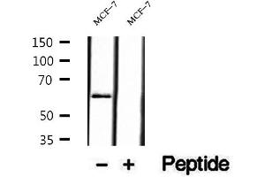 Western blot analysis of extracts of MCF-7 cells, using P4HA2 antibody. (P4HA2 抗体  (Internal Region))