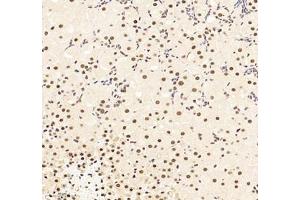 Immunohistochemistry of paraffin embedded mouse adrenal gland using RBM8A (ABIN7075478) at dilution of 1: 300 (300x lens)