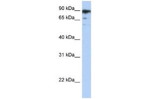 WB Suggested Anti-RBAK Antibody   Titration: 1. (RBAK 抗体  (Middle Region))