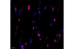 Immunofluorescence of paraffin embedded mouse Skeletal muscle using USP24 (ABIN7076111) at dilution of 1:650 (400x lens) (USP24 抗体)