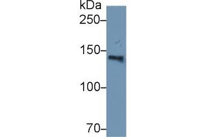 Western Blot; Sample: Human Serum; Primary Ab: 2µg/ml Rabbit Anti-Human HYOU1 Antibody Second Ab: 0. (150 kDa Oxygen Regulated Protein (AA 695-994) 抗体)