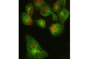 FOXP1 Antibody HeLa Cell IF.