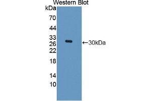 Western blot analysis of the recombinant protein. (ROCK1 抗体  (AA 1094-1323))